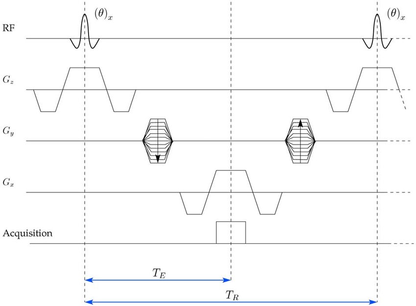 bSSFP pulse sequence diagram