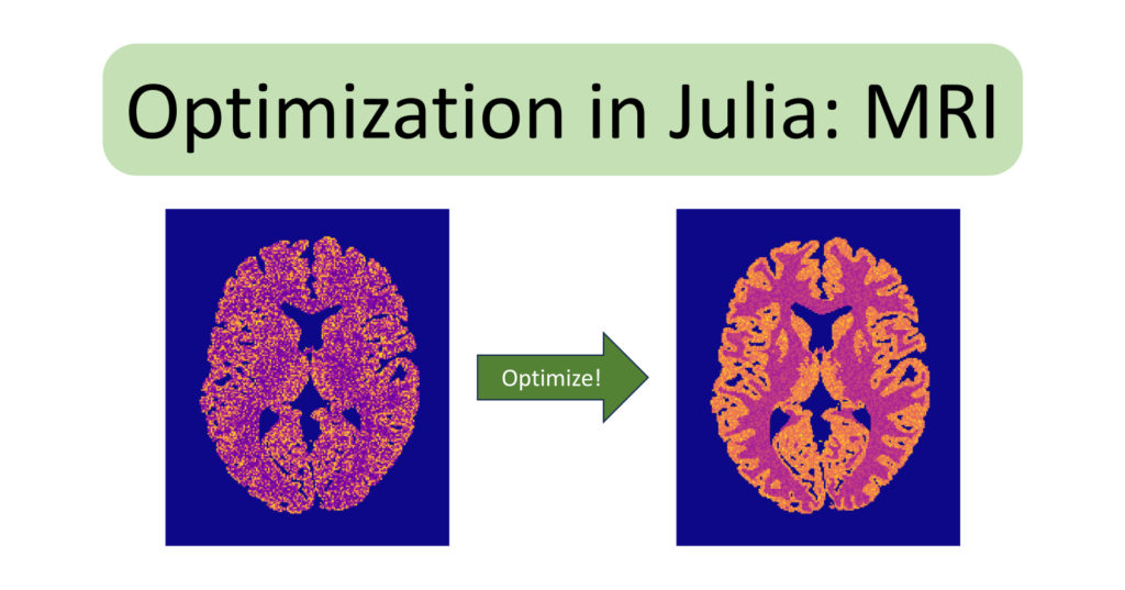 Efficient Julia Optimization through an MRI Case Study